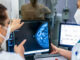 How a mammogram may perchance back name heart illness How a mammogram may perchance back name heart illness