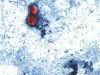 Michigan experiences first 2 US deaths in cyclospora outbreak Michigan experiences first 2 US deaths in cyclospora outbreak